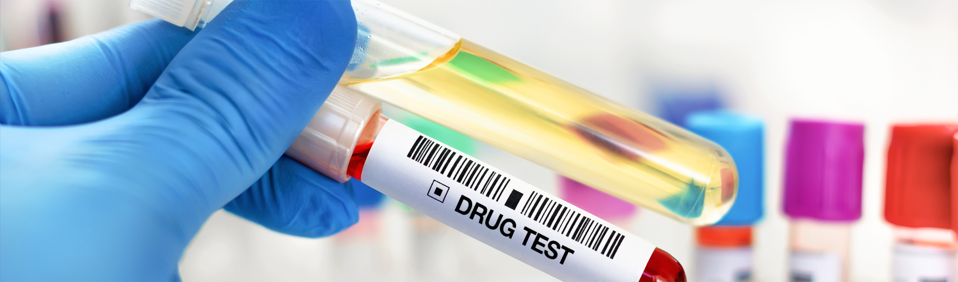 Drug & Alcohol Testing